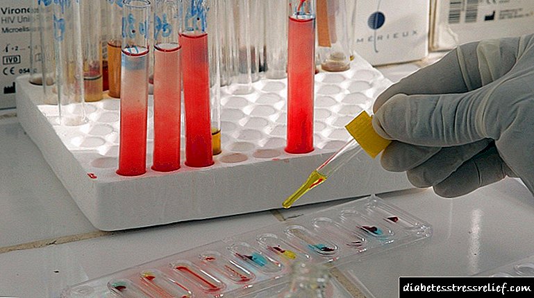 နာတာရှည်ပန်ကရိယရောဂါအတွက်စမ်းသပ်မှုများ