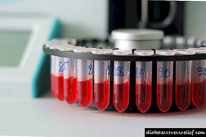 Testet e gjakut, urinës dhe fecesit për pankreatitin: rezultatet e treguesve