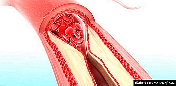 Decryption sanguinem cholesterol ad mensam primordium
