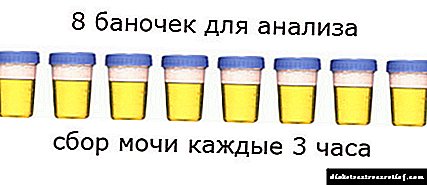 Urinalysis miturut Zimnitsky: koleksi urin, dekoding asil, fitur