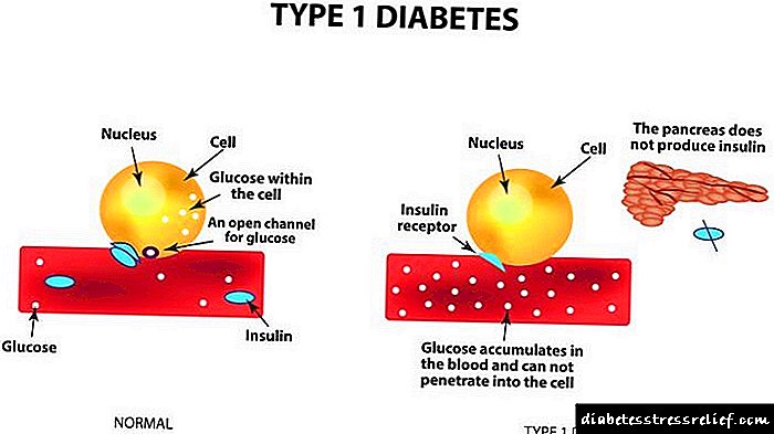 Кант диабети менен антителолор диабети: диагностикалык анализ