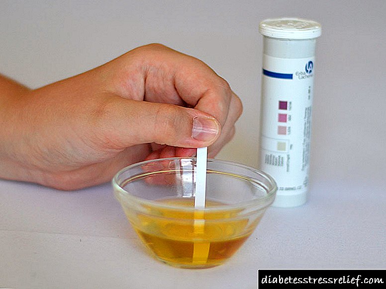 Asetoon in urine: oorsake by volwassenes, transkripseanalise