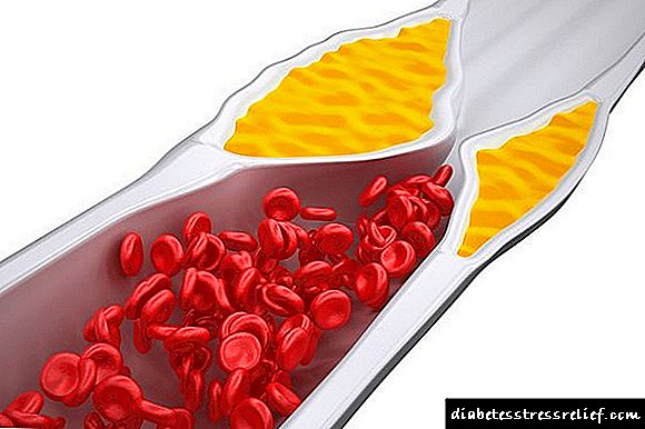 Cilat ushqime largojnë kolesterolin nga trupi