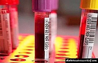 AlAT dhe ASAT në gjak: teste të mëlçisë për enzimat e mëlçisë