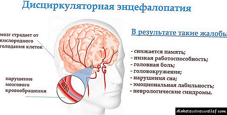Gịnị bụ encephalopathy discirculatory: onyonyo a na-adakarị na ụzọ esi agwọ ọrịa ahụ