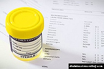 Quid sibi vult acetone in urina est sana in diabete et hominibus: Causis et Treatment ACETONURIA