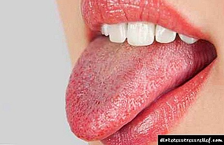 Tongue i roto i te mate huka: he whakaahua o nga mate hakihaki