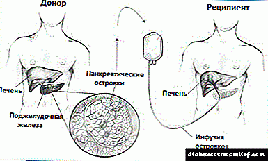 Ungayibuyisela kanjani i-pancreas enoshukela