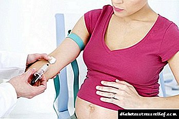 Para resultados precisos: proba de tolerancia á glicosa durante o embarazo e como prepararse para ela