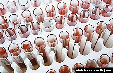 Análise da hemoglobina glicada: como tomar, preparar, indicadores, norma e desviacións