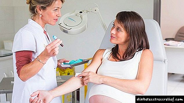 Тест за толеранција на глукоза за време на бременоста - подготовка и однесување