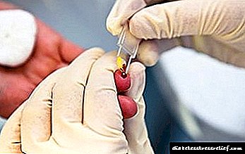 Exame de sangue no dedo: taxa de azucre en homes, mulleres e nenos