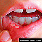 Bidliet fil-kavità orali bid-dijabete