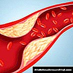 Kolesterolo en diabeto - kiel batali