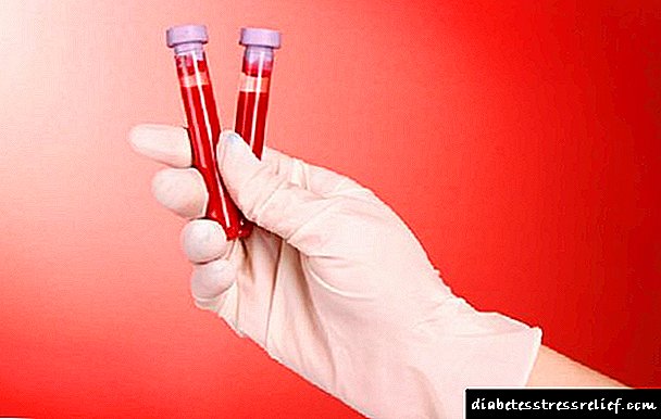 Test i gjakut për insulinë