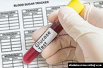 Тест на шеќер во крвта и неговата норма