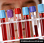 Sangue para o perfil glicémico: como facer unha proba de diabetes?