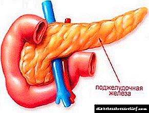 Pancreatic lipomatosis - nws yog dab tsi