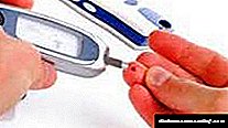 Усулҳои табобат кардани диабетҳо дар клиникаи хуби клиникӣ