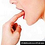 Կարո՞ղ եմ սխտոր ուտել ենթաստամոքսային գեղձի պանկրեատիտով