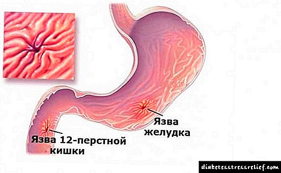 Necrosis pancreatic
