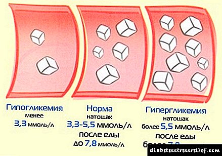 Normalni pokazatelji šećera u krvi: normalni i odstupanja, metode ispitivanja i metode normalizacije