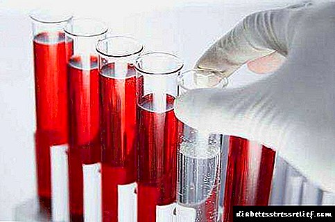 Normas de análise bioquímicas do sangue, descodificación, razóns para aumentar e diminuír indicadores na táboa