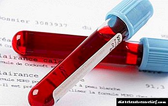 Optimal Niveaue vu glycéiertem Hämoglobin am Blutt: Norme fir gesond Leit an Diabetiker