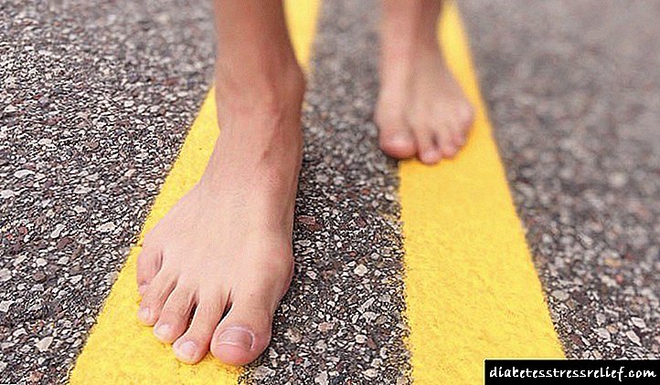 Bolesti stopala sa dijabetesom: šta su, kako i kako ih liječiti?