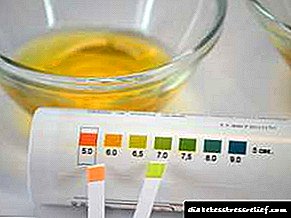 Komplikimet e diabetit: aceton në urinë