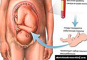 Diabetic fetopathy sa fetus ug mga masuso