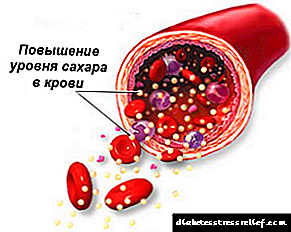 Corpus temperatus in excelsum typus II diabetic patientes diabetes Mellitus, quam pulsamus