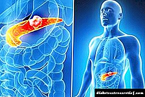 Giunsa mahibal-an ang mga problema sa pancreatic?