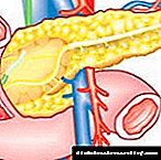 Problemau pancreas: symptomau (arwyddion), triniaeth a diet