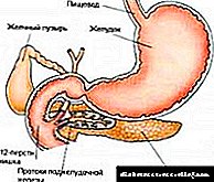 Pseudotumor pancreatitis