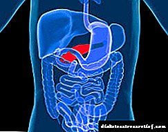 Ang cancer sa pancreatic - mga yugto, unang sintomas at pagpapakita, paggamot