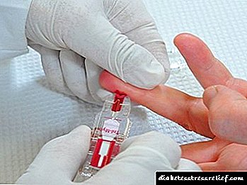 Test i gjakut për sheqerin gjatë shtatëzanisë: normë, tabela, transkript
