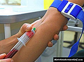Tés pikeun hemoglobin glikét: norma pikeun lalaki sareng awéwé kalayan diabetes