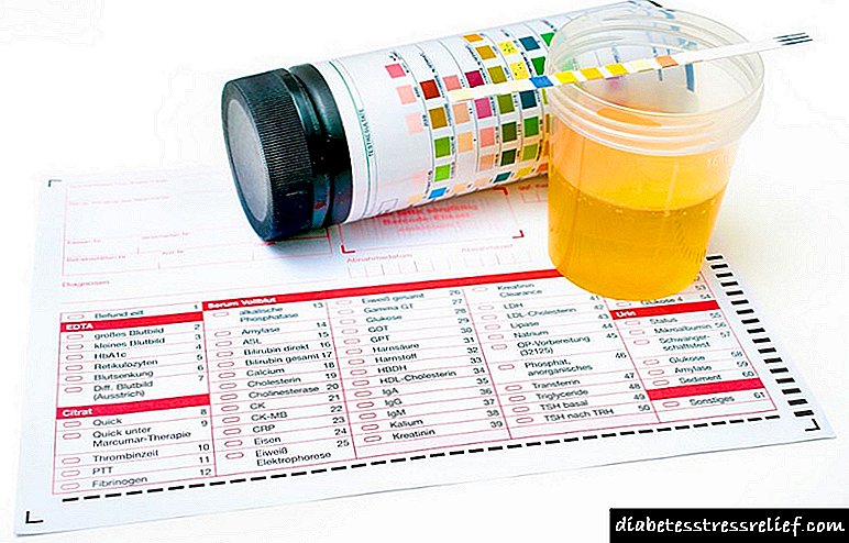 Тест ленти за ацетон во урина: упатства за употреба, цена