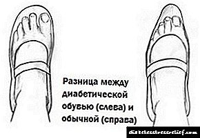 Karakteristike ortopedske cipele za dijabetičare