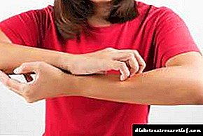 Лезија на кожата кај дијабетес: фотографија на дијабетична дермопатија